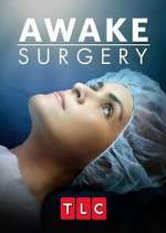 Watch Awake Surgery 123moviesfree